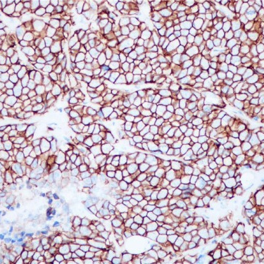 HER2 Rabbit Monoclonal Antibody(ARB820)