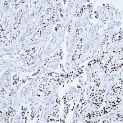 PR Rabbit Monoclonal Antibody(ARB821)