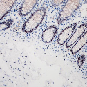 MSH6 Rabbit Monoclonal Antibody(ARB825)