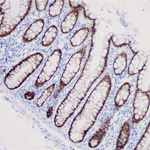 CDX2 Rabbit Monoclonal Antibody(ARB826)