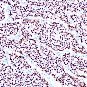 ER Rabbit Monoclonal Antibody(ARB828)