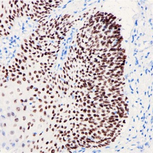 p40 Rabbit Monoclonal Antibody(ARB829)