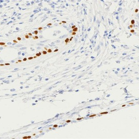 p63 Rabbit Monoclonal Antibody(ARB831)