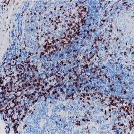 CD3 Rabbit Monoclonal Antibody(ARB832)