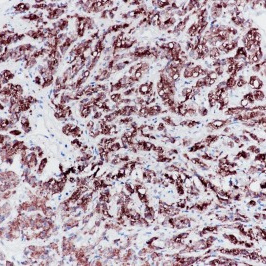 PSA Rabbit Monoclonal Antibody(ARB833)