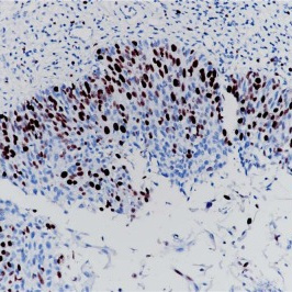 Ki67 Rabbit Monoclonal Antibody(ARB834)