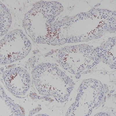 SYP Rabbit Monoclonal Antibody(ARB835)