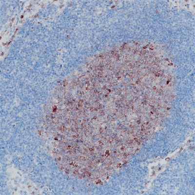 CD10 Rabbit Monoclonal Antibody(ARB836)