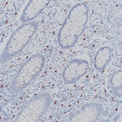 CD117 Rabbit Monoclonal Antibody(ARB837)