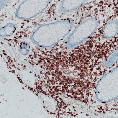 CD45 Rabbit Monoclonal Antibody(ARB838)