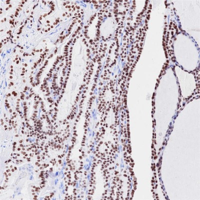 TTF1 Rabbit Monoclonal Antibody(ARB839)