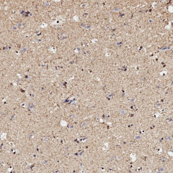 S100 Rabbit Monoclonal Antibody(ARB841)