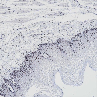 PMS2 Rabbit Monoclonal Antibody(ARB844)