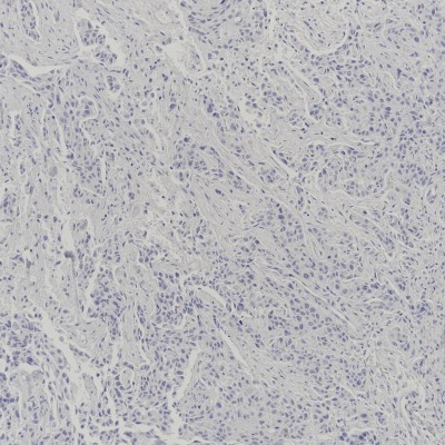 ER Rabbit Monoclonal Antibody(ARB845)