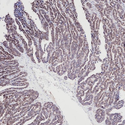 PAX8 Rabbit Monoclonal Antibody(ARB846)