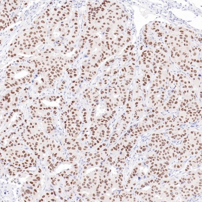 TRPS1 Rabbit Monoclonal Antibody(ARB847)