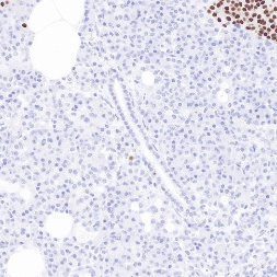 INSM1 Rabbit Monoclonal Antibody(ARB848)