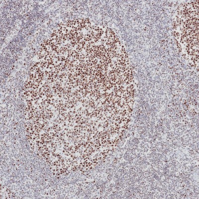 MSH2 Mouse Monoclonal Antibody(ARB849)