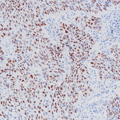 p53 Mouse Monoclonal Antibody(ARB851)