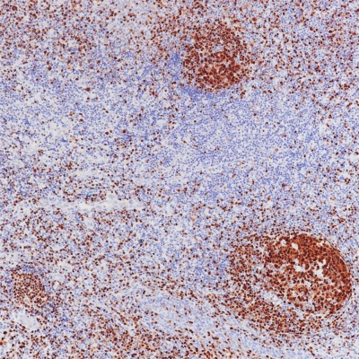 BSAP(PAX5) Mouse Monoclonal Antibody(ARB852)