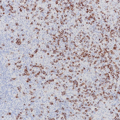 CD15 Mouse Monoclonal Antibody(ARB853)