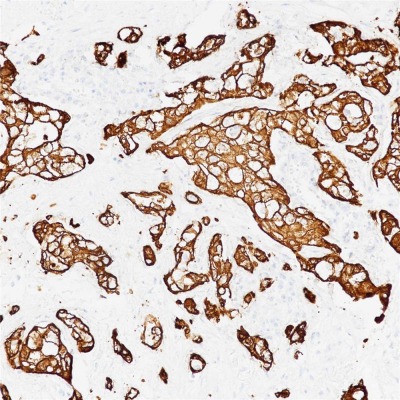Cytokeratin 8 Rabbit Monoclonal Antibody(ARB855)