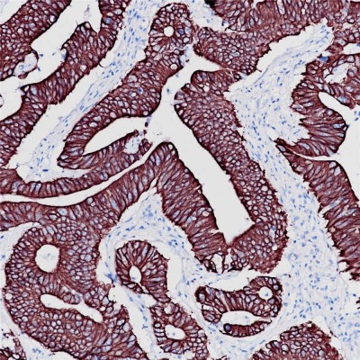 Cytokeratin 18 Rabbit Monoclonal Antibody(ARB856)