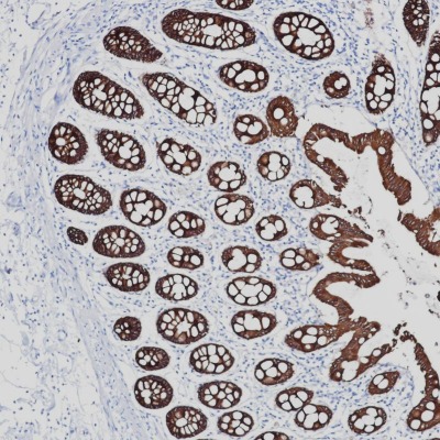 CK8/18 Rabbit Monoclonal Antibody Cocktail(ARB855/ARB856)
