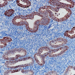 Type I Cytokeratins Rabbit Monoclonal Antibody(ARB857)