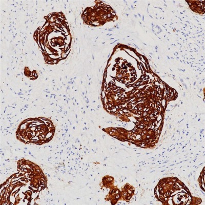 Type II Cytokeratins Rabbit Monoclonal Antibody(ARB858)