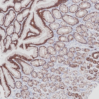 CK-PAN Rabbit Monoclonal Antibody Cocktail(ARB857/ARB858)