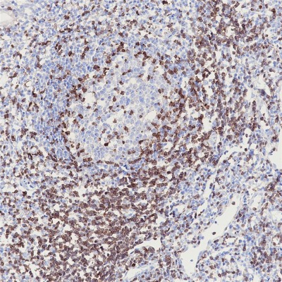 ZAP-70 Rabbit Monoclonal Antibody(ARB859)