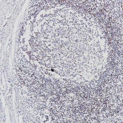 FOXP1 Rabbit Monoclonal Antibody(ARB861)