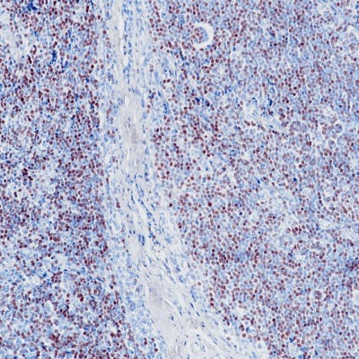 SOX-11 Rabbit Monoclonal Antibody(ARB862)