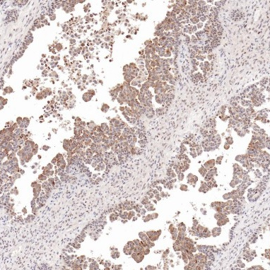 HE4 Rabbit Monoclonal Antibody(ARB863)