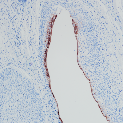 Uroplakin III Rabbit Monoclonal Antibody(ARB865)