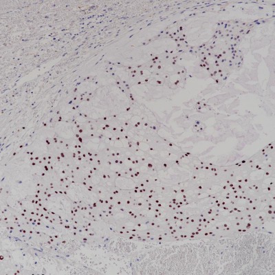 Brachyury Rabbit Monoclonal Antibody(ARB866)
