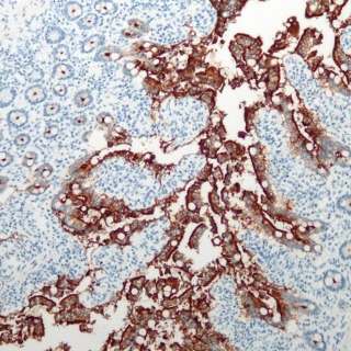 ACE2 Rabbit Monoclonal Antibody(ARB867)
