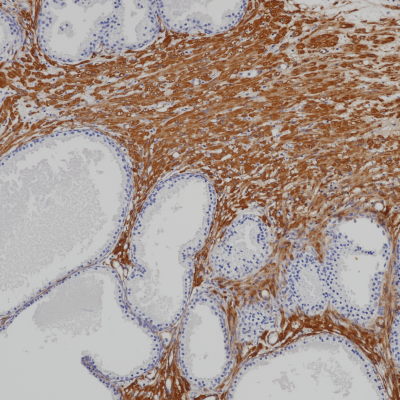 Actin (Smooth Muscle) Mouse Monoclonal Antibody(ARB868)