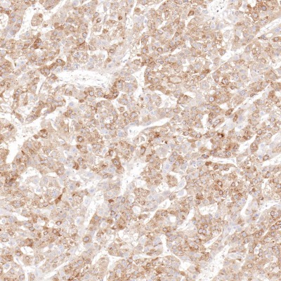 AFP Rabbit Monoclonal Antibody(ARB869)