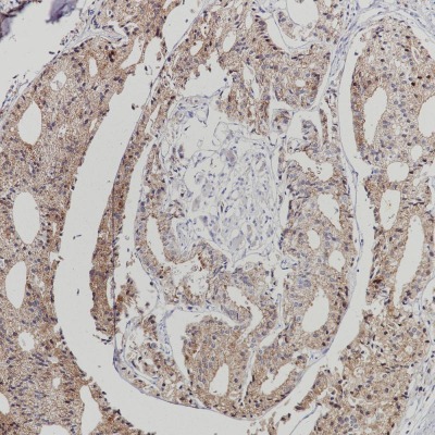 AMACR Rabbit Monoclonal Antibody(ARB871)