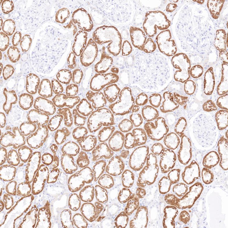 AMACR Mouse Monoclonal Antibody(ARB872)