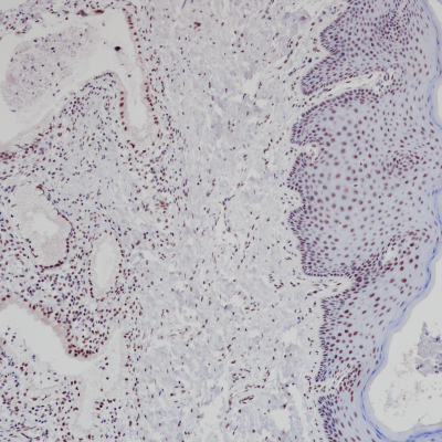 ATRX Rabbit Monoclonal Antibody(ARB876)
