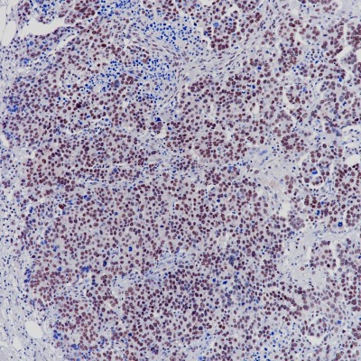 BAP-1 Rabbit Monoclonal Antibody(ARB877)