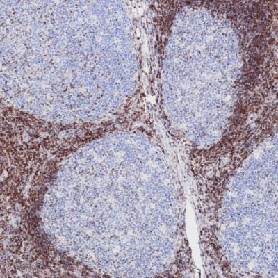 Bcl-2 Mouse Monoclonal Antibody(ARB878)