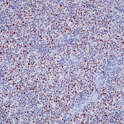 Bcl-6 Rabbit Monoclonal Antibody(ARB879)