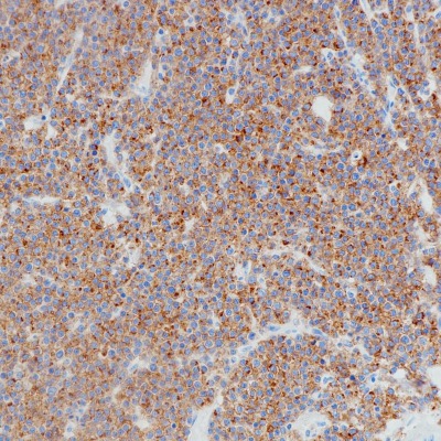BCMA Rabbit Monoclonal Antibody(ARB881)