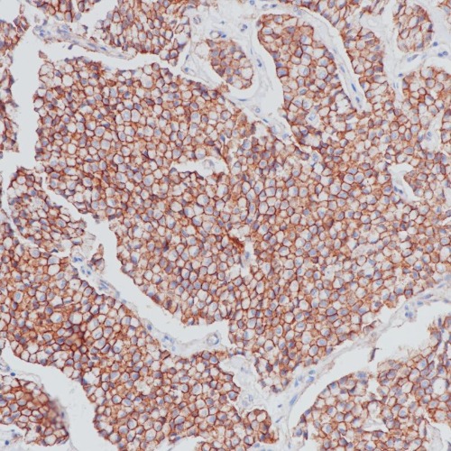 Beta-Catenin Rabbit Monoclonal Antibody(ARB882)