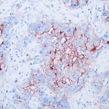 CA125 Rabbit Monoclonal Antibody(ARB884)