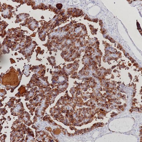 Calcitonin Rabbit Monoclonal Antibody(ARB885)